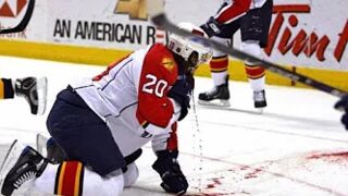 Try Not To Look Away Challenge! Worst NHL Injuries