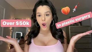 OVER $50K IN PLASTIC SURGERY (telling all my procedures) ????????