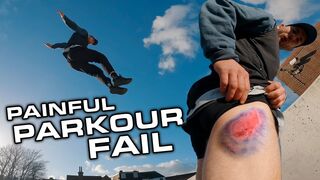 Harsh Reality of Street Parkour ????????